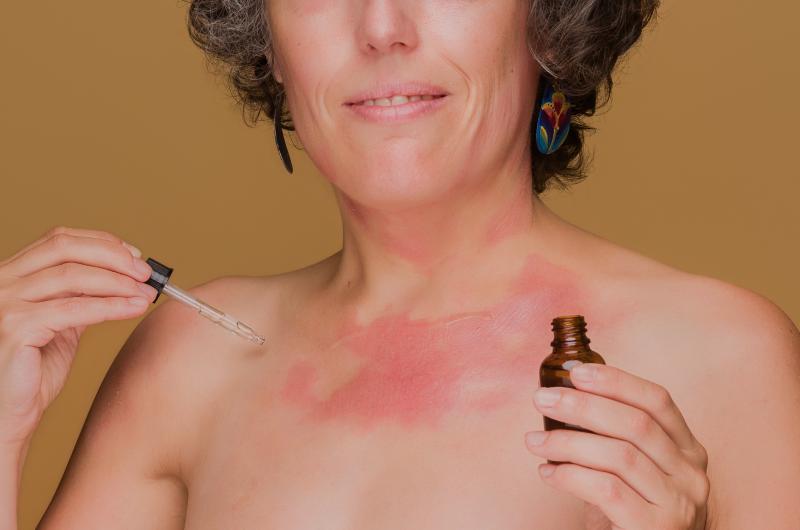 Citlivá kůže po 65: Jak správně pečovat o pokožku, když sprcha nestačí